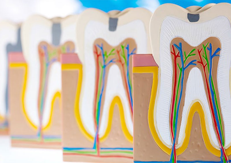 根管治療
