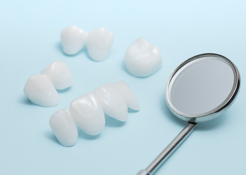 美しいだけではない、審美セラミック治療