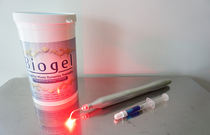 歯周病治療の新しい選択肢、ペリオウェイブ・システムとは？