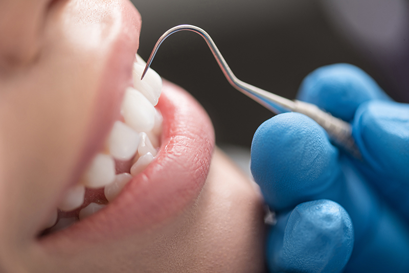 進行した歯周病に対する治療法