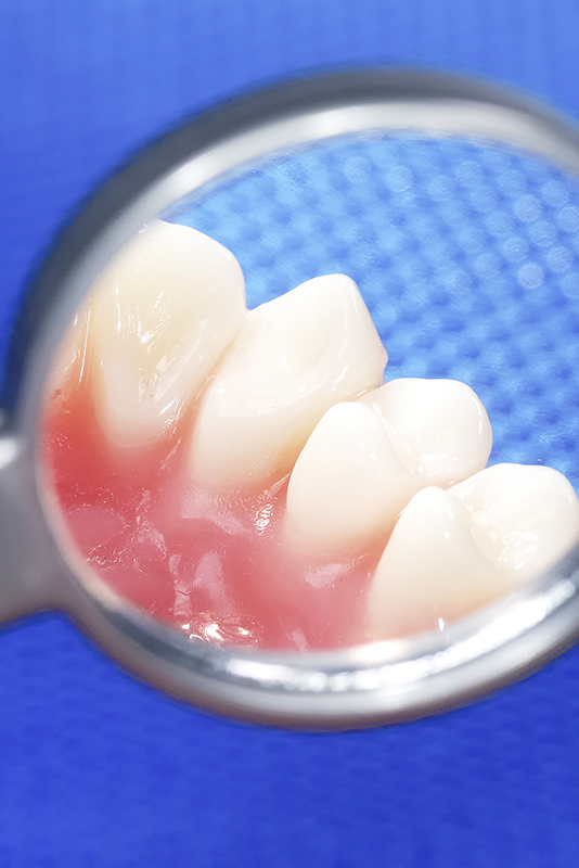 ペリオウェイブ・システム